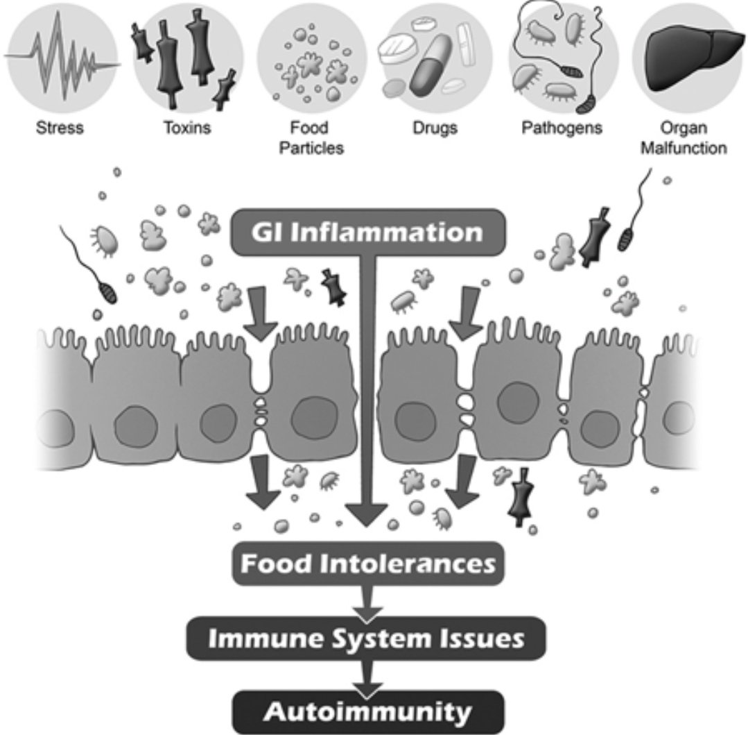 Autoimmune Issues are for the most part Gut Issues.

A Gut friendly diet & Lifestyle can put most Autoimmune conditions into Remission.

#RA #Celiacs #Psoriasis #Hashimotos #AnkylosingSpondylitis