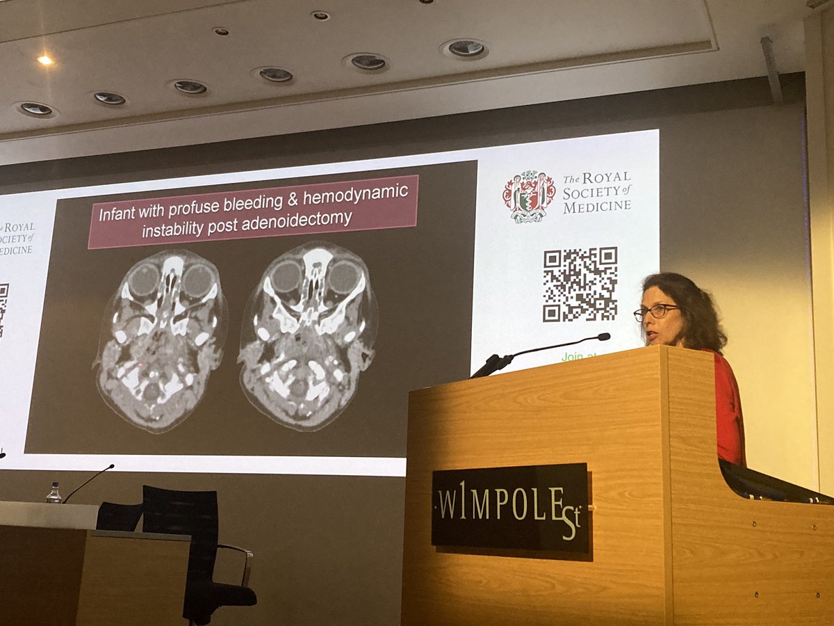 Neshe (@ridinghighinapr) on Twitter photo A brilliant Peter Phelps Commemorative Lecture by <a href="/callyrobs/">Caroline Robson, MBChB</a> on Paediatric H&N Emergencies <a href="/BSHNI_UK/">British Society of Head & Neck Imaging</a> A brilliant Peter Phelps Commemorative Lecture by <a href="/callyrobs/">Caroline Robson, MBChB</a> on Paediatric H&N Emergencies <a href="/BSHNI_UK/">British Society of Head & Neck Imaging</a>