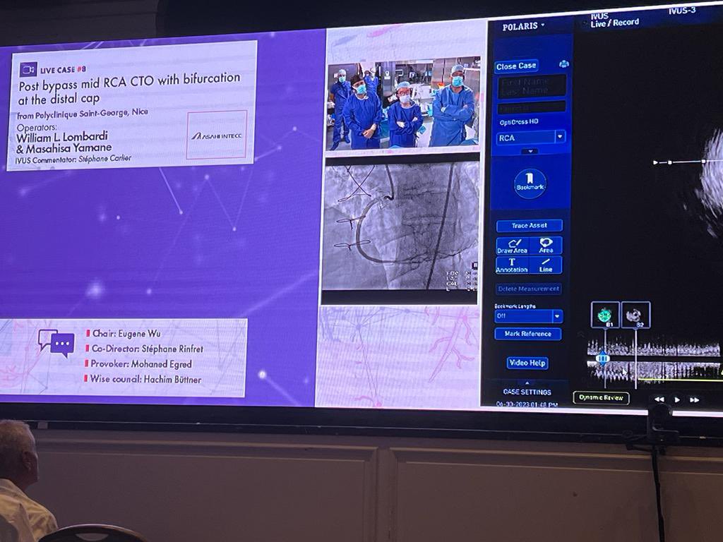 Incredible PCI duo operators during #MLCTO2023

Talent + Wisdom + Experience = Excellence 

#cardiology #CTO #PCI