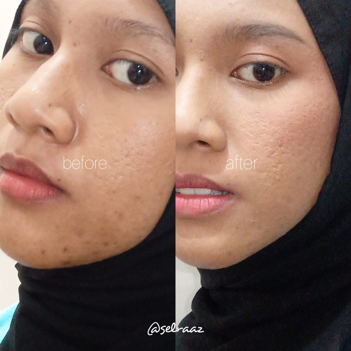 sel • skincare learner tweet media