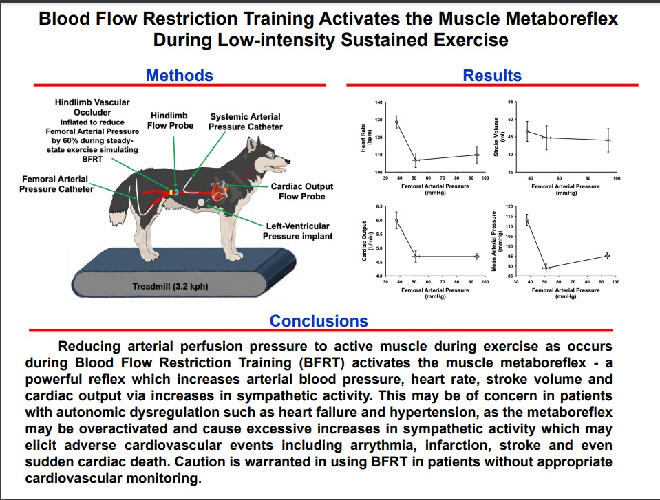 japplphysiol's tweet photo. #ArticlesInPress โBlood Flow Restriction Training Activates the Muscle Metaboreflex During Low-intensity Sustained #Exerciseโ Joseph Mannozzi, et al.
๐ฑ๏ธhttps://t.co/FB22yw1YgE #JAPPL
#BFR #MuscleMetaboreflex @waynemedicine https://t.co/ZcdFwpu50r
