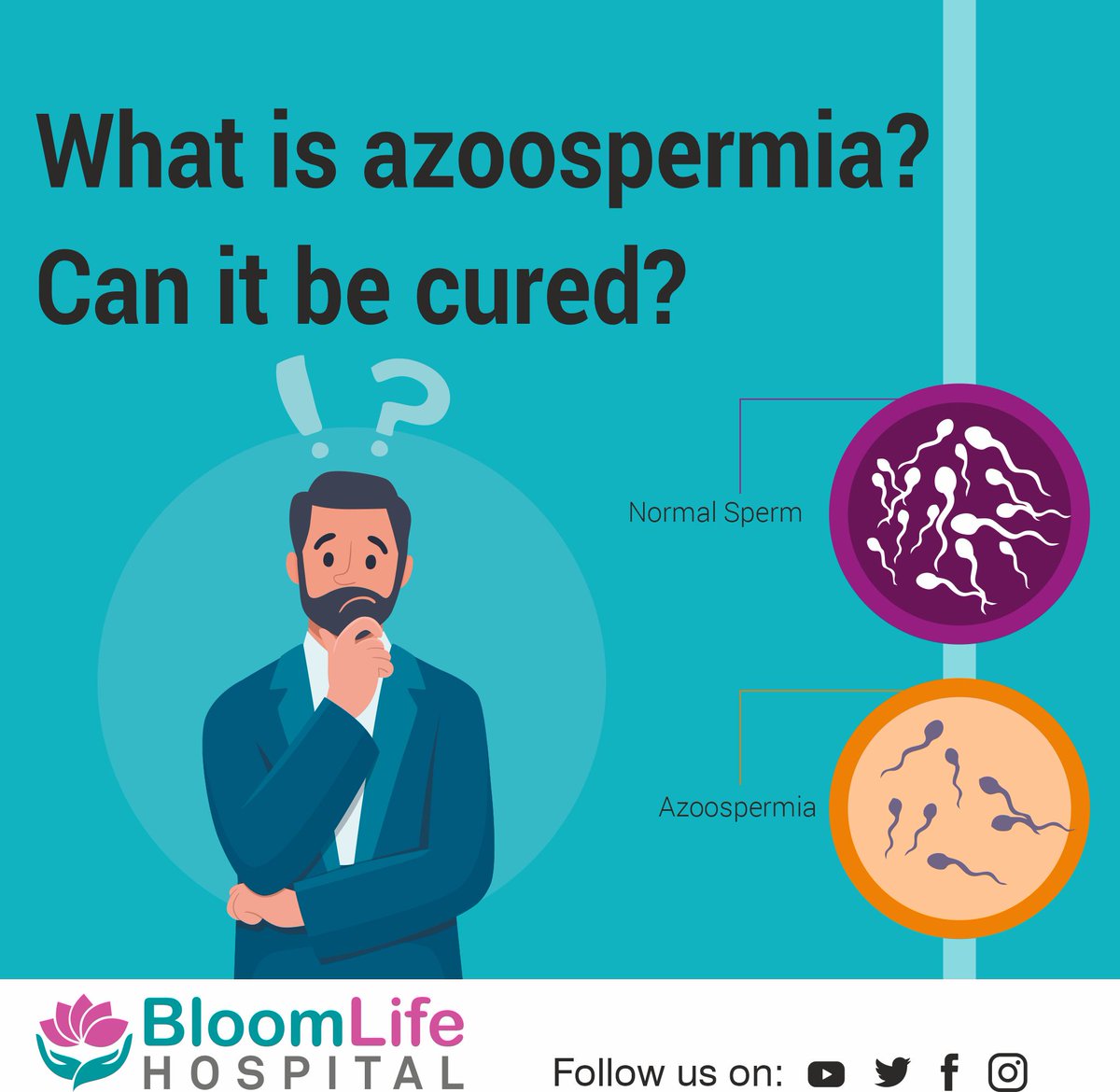 𝐖𝐡𝐚𝐭 𝐢𝐬 𝐚𝐳𝐨𝐨𝐬𝐩𝐞𝐫𝐦𝐢𝐚? 𝐂𝐚𝐧 𝐢𝐭 𝐛𝐞 𝐜𝐮𝐫𝐞𝐝?

Azoospermia refers to a lack of identifiable sperms in semen samples taken on two different occasions. This is one of the main causes of male infertility.

#Azoospermia #MaleInfertility #FertilityIssues