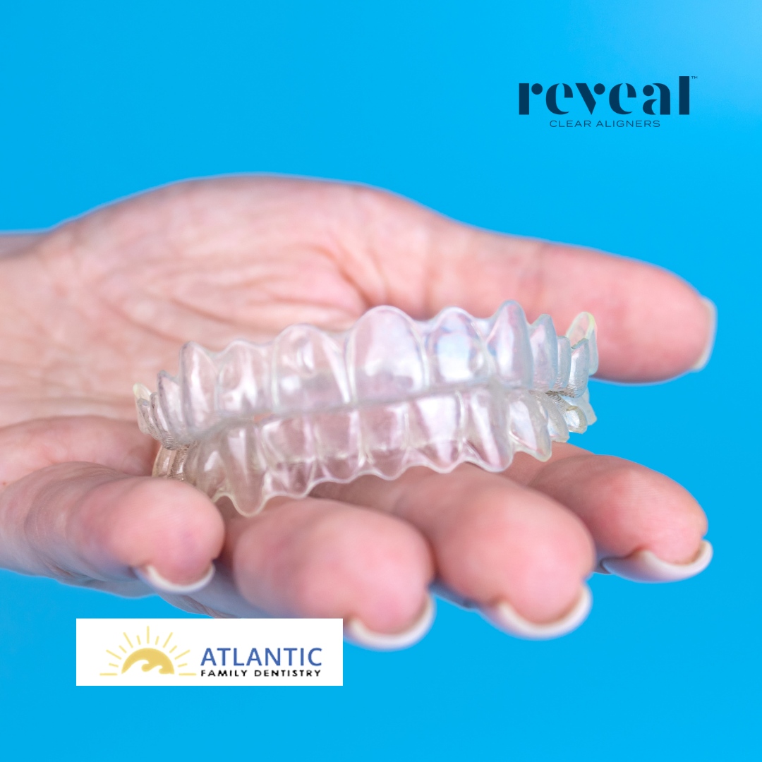 Say goodbye to discomfort and embarrassment with Reveal braces. This revolutionary new system straightens teeth without wires or wax, making it the perfect alternative to traditional metal braces for people of all ages. #RevealBraces #SmileConfidently #TeethStraightening
