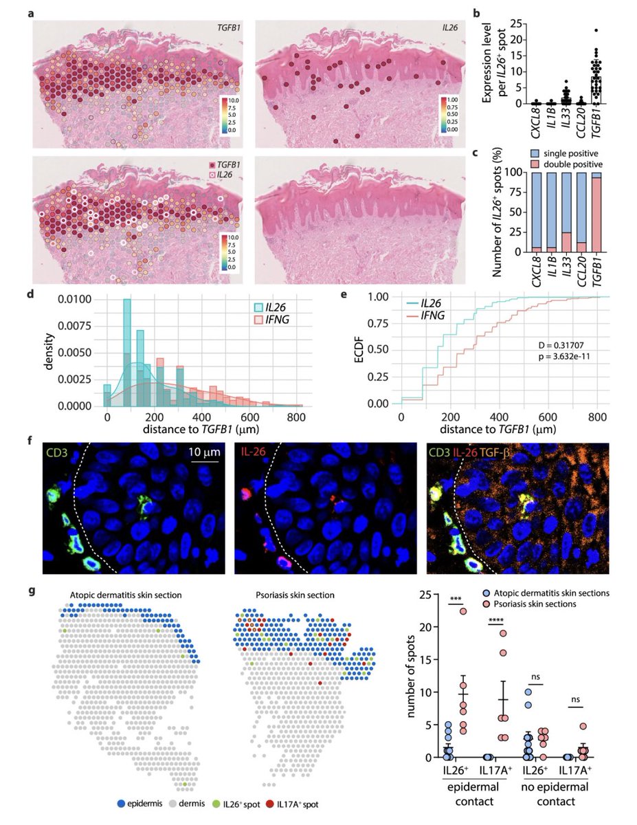 I’m pleased to share our new #research study published in <a href="/NatureComms/">Nature Communications</a> in which we demonstrate that skin resident IL-26+ T cells are TH17 intermediates that further differentiate into IL-17A producers when exposed to epithelial TGF-b in #psoriasis. rdcu.be/dfLqb