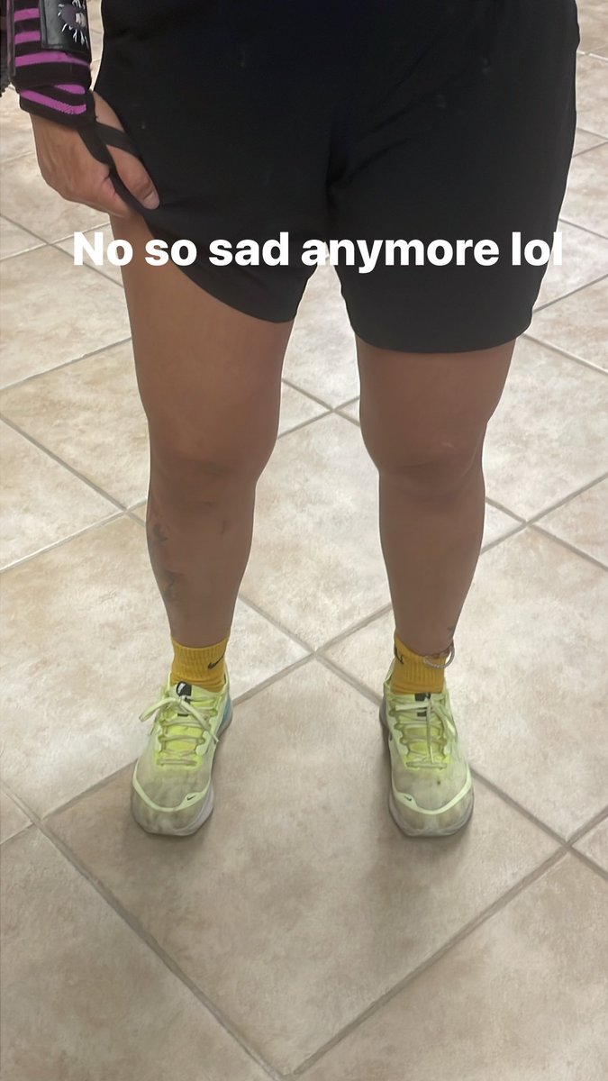 mizuho1901's tweet photo. Today marks 6 months since my #tornmeniscus #ACLsurgery it’s been long and tedious but we’re getting there.. can’t wait to get back into kicking some things and people 😂 #neverskipyourlegdays @XP_Nightingale @ShyGaladriel @morticia_mo https://t.co/uHmveUWgpw