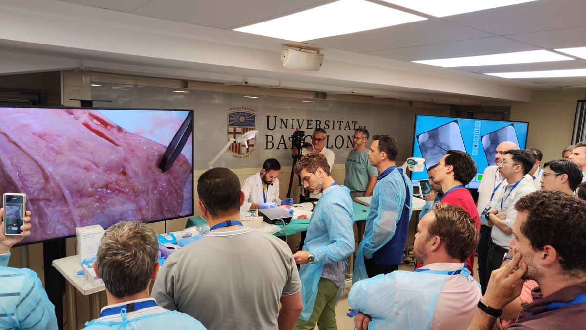 institutrabat's tweet photo. 2nd day of the Basic Foot&amp;Ankle Minimally Invasive Surgery Course. Today's topics
✅ Percutaneous Chevron
✅ Percutaneous Calcanial Osteotomy.

#halluxvalgus #hallux #MIS #orthopedics #medicine #Barcelona https://t.co/lOTQeIFEIP