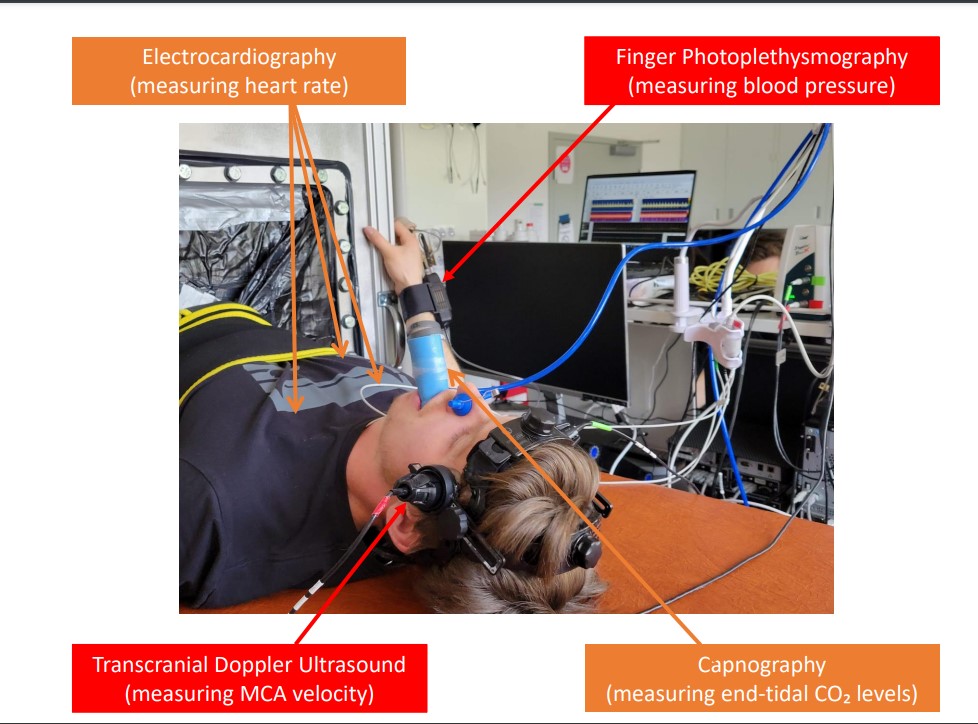 japplphysiol's tweet photo. #JAPPL #ArticlesInPress “The Effect of Supine Cycling and Progressive Lower Body Negative Pressure on Cerebral Blood Velocity Responses”
Lauren N. Miutz et al.
👉https://t.co/SpHfLxFKWi
@Pat_Brassard #SupineCycle @univofdayton https://t.co/LgP61FIIuI