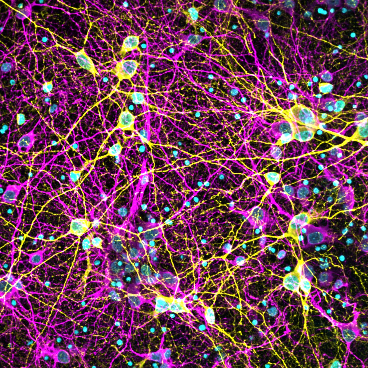 Wendy Xueyi Wang (@awedness) on Twitter photo Back to the brain and microscopes. Pretty thankful this #FluorescenceFriday Back to the brain and microscopes. Pretty thankful this #FluorescenceFriday