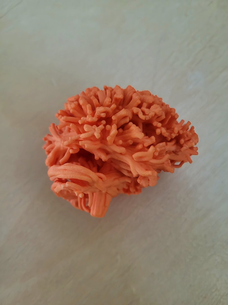 hyabmehari's tweet image. Learning about the movement of water in more ways than one this week with @ExploreDTI in beautiful Bergen! Can&apos;t wait to get stuck into the analysis of the DINAMITE data from  @claireconwayphd SFI funded program  @scienceirel. #anatomicalmodels #DTI @TissueEngDublin