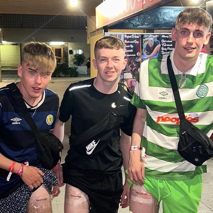 When you come back from the lads holiday with Partizan ink 😂 our young team making their mark on and off the pitch 💉👏🏼

#ForzaPartizan ⚫️⚪️