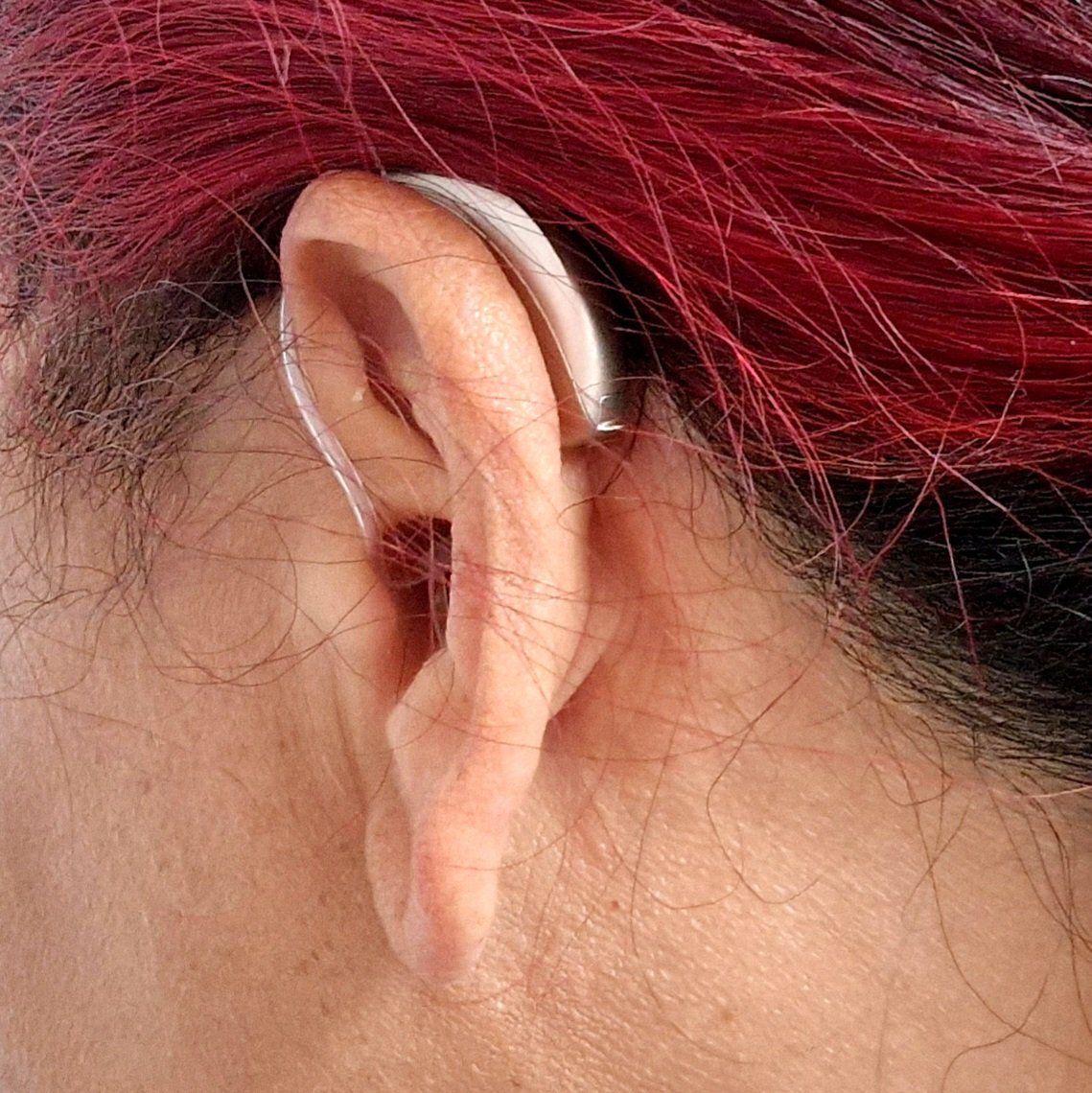 BlueSky8689's tweet photo. Ooh the gift of hearing! Thank you #NHS. After 8 muffled months post meningitis, I am sitting looking out of the window enjoying the sound of the rain falling on the grass!
#hearing
#hardofhearing
#dDeaf
@NewcastleHosps https://t.co/fpMiwEkDPJ