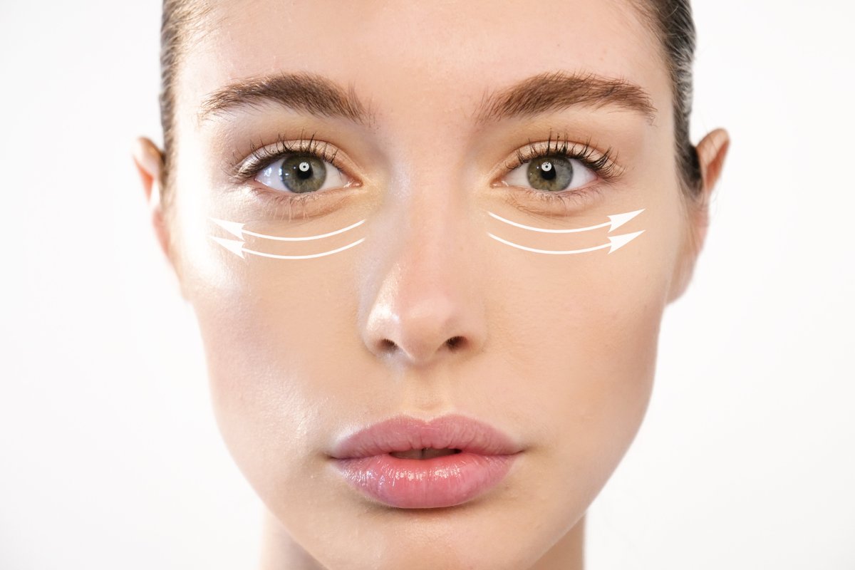 RSMedSpa's tweet image. Say goodbye to #UnderEye #Wrinkles with #Botox! Visit our website to learn more. #renomedspa renosparksmedspa.com/video-gallery/…