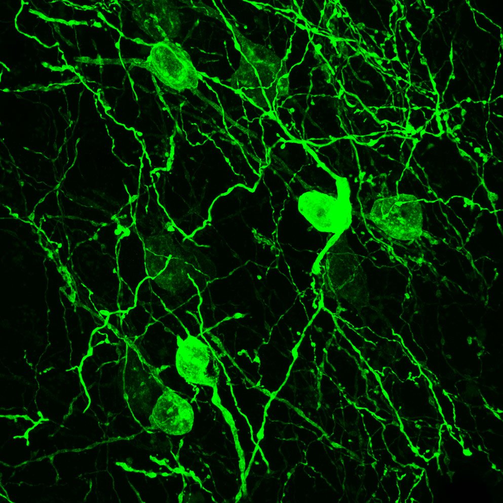 NikoRigney's tweet photo. Best Friday afternoon = hitting 'submit' on a revised manuscript #FluorescenceFriday (BNST AVP neurons) https://t.co/OIuyaHnqZo