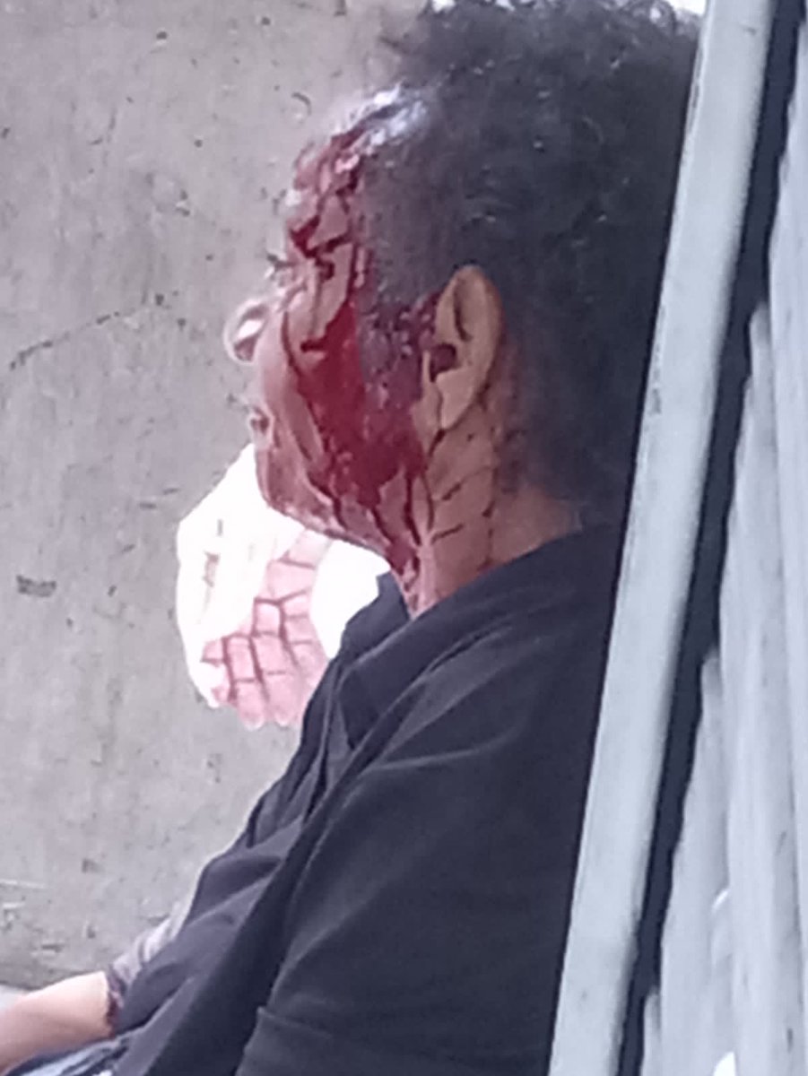 FrancisG_10's tweet photo. La Foto más triste que veras hoy,
@ElSoldelaMana la recuerdas ? https://t.co/gNKJaEwlOO