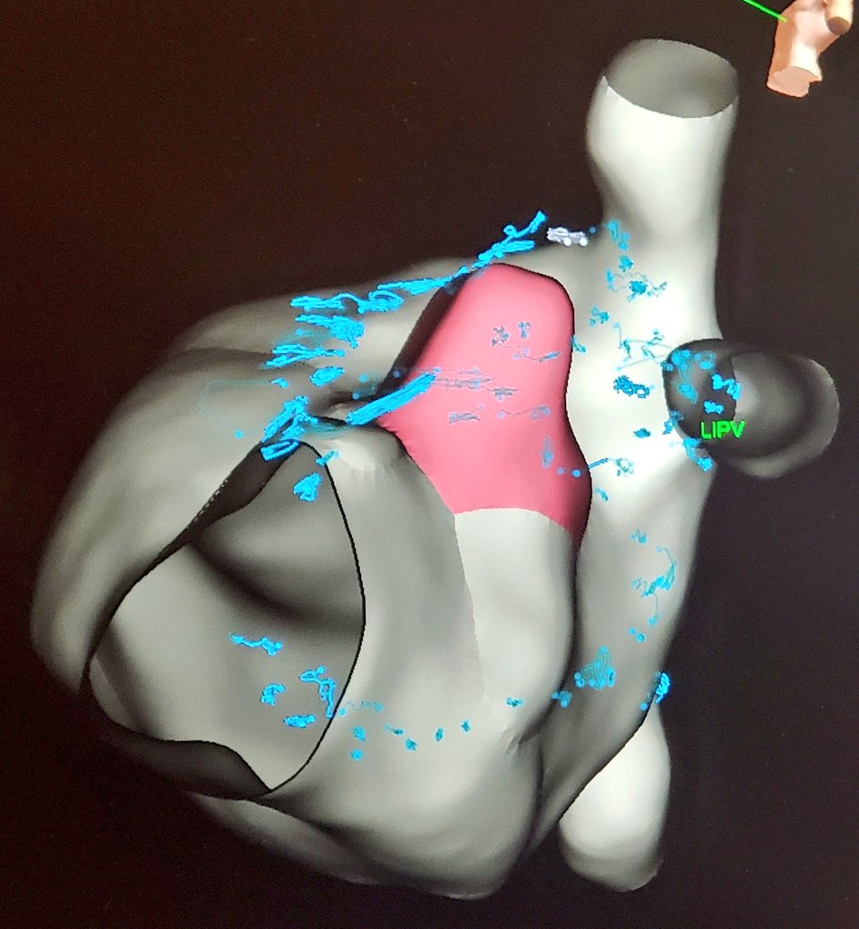 Josh Shriver tweet media