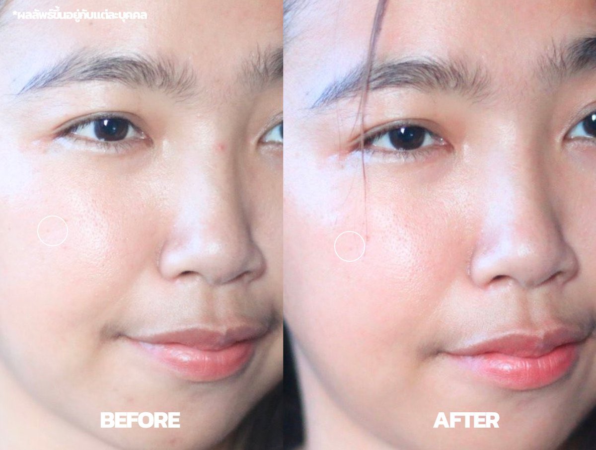 ซุ่มใช้มา 4 วีค อึ้งในผลลัพธ์พวกรอยลดลงเยอะ อินนิสฟรี วิตามินซี กรีนที เอนไซม์ ไบร์ทเทรนนิ่ง เทียบกับบำรุงปกติ ผิวไบร์ทขึ้น4 เท่า สารสกัดจากธรรมชาติผิวแพ้ง่ายใช้ได้ ผิวสวยใสดูดีแบบธรรมชาติ เซรั่มเข้มข้น ซึมเข้าผิวไว แนะนำเลย #เดบิวต์ผิวไบร์ท #INNISFREEVitac #innisfreethailand