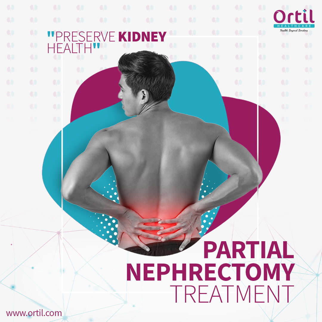 Partial Nephrectomy is a surgical procedure that removes only the affected part of the kidney, sparing the healthy tissue.  Our expertise in connecting patients with top-notch medical facilities ensures a seamless experience for those seeking advanced treatments.
#kidneyhealth