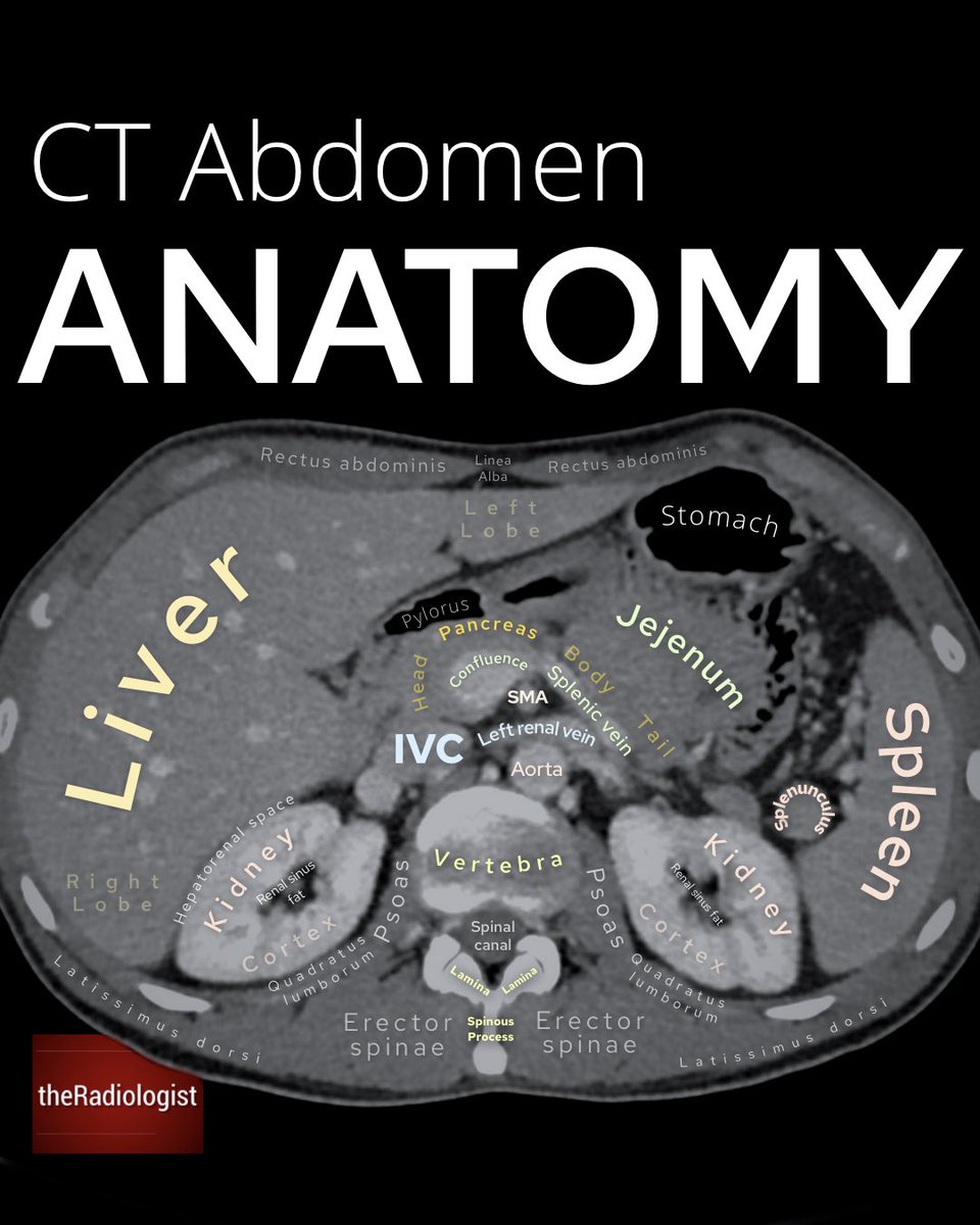 Abdominal CT anatomy