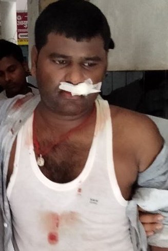 रोजगार मांग रहे युवा को नीतीश-तेजस्वी सरकार ने लाठी से लहू लुहान किया। 🤬

खून के दाग देखिए <a href="/yadavtejashwi/">Tejashwi Yadav</a> जी, ये कोई आतंकवादी नहीं है बेरोजगार है; थोड़ा तो रहम कीजिए।