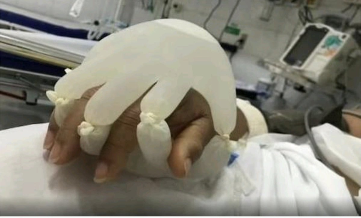 IkNet's tweet image. Dat gezonde mensen verboden werd bij het sterfbed van hun dierbare aanwezig te zijn, was onnodig wreed en wetenschappelijk onjuist;mensen zonder klachten zijn niet besmettelijk.  #hugodejonge #coronabeleid 

Ik wist het.  Zij wisten het ook.

(Kuipers wil de onderbouwing van het…