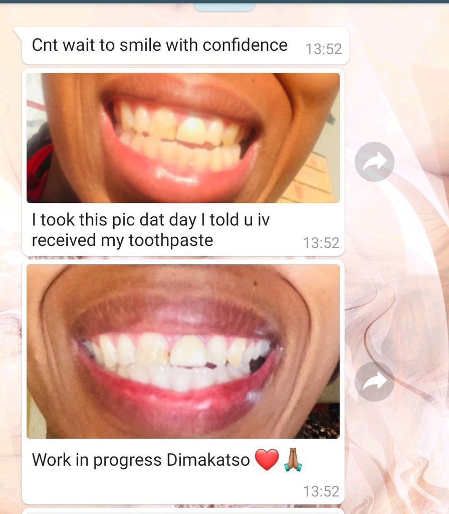 Lush_Beauty1's tweet photo. Use AP 24 Whitening Fluoride Toothpaste x2 a day for sensationally white teeth you can smile about!! 😁
Whatsapp 0749777590
#SmileWithDima
#90dayswithoutsugar https://t.co/KwlqEA1ek1
