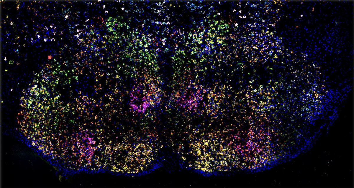 SihRong_Wu's tweet photo. So happy to have my PhD work published! We reveal the critical role of Atoh1 in establishing the heterogeneity of the pontine nuclei neurons! I am thankful to work with the wonderful team in #ZoghbiLab!
https://t.co/gUXhkkaySF https://t.co/wMXGtEjj2b