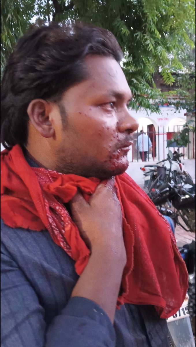 #Fatehpur.  अपराधी में नहीं रहा किशनपुर पुलिस का खौक। थुरियानी चौराहे में अपने ही गाँव के एक युवक को कनपटी से सटाकर मारी गोली। <a href="/Uppolice/">UP POLICE</a> <a href="/dmfatehpur/">DM/DEO FATEHPUR</a> <a href="/fatehpurpolice/">FATEHPUR POLICE</a> <a href="/igrangealld/">IG Range Prayagraj</a> <a href="/ADGZonPrayagraj/">ADG Zone Prayagraj</a>
<a href="/007vivekmishra/">Vivek mishra 007</a> 
<a href="/kamalsahu3/">kamal sahu</a> 
<a href="/Niranjan_4050/">Niranjan Yadav Journalist</a> 
<a href="/PragyaLive/">Pragya Mishra</a> 
<a href="/YadavManish029/">Manish Kumar</a>