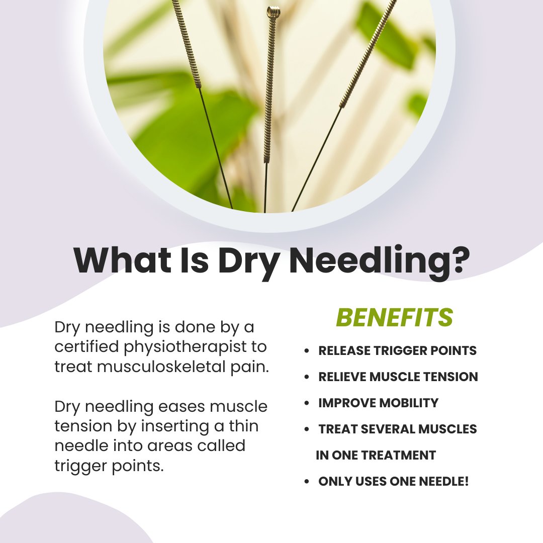 Dry Needling provided by our Physiotherapists Reshma Mehta, Urvi Panchal, &amp; Uma Acharekar

Visit our Physiotherapy page to learn more about Dry Needling.
royaltreatmenttherapeutics.com/physiotherapy-…