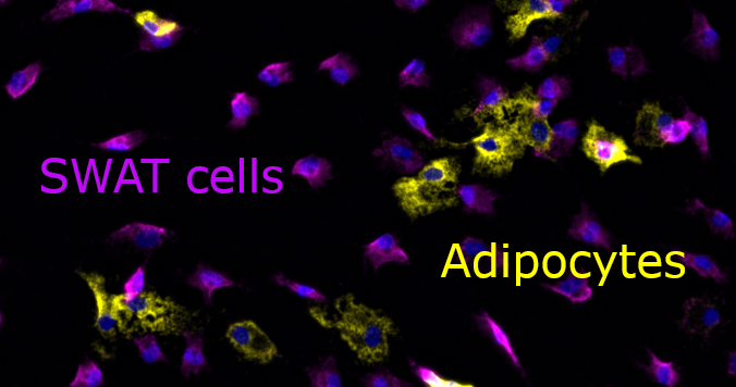 Carla Horvath (@carla_horv) on Twitter photo Very excited to share my first author contribution to our single cell study in <a href="/NatMetabolism/">Nature Metabolism</a>🥳! The peculiar SWAT cell develops from the same progenitor as adipocytes, secretes extracellular matrix and is multipotent... Read more 🧐👉nature.com/articles/s4225… Very excited to share my first author contribution to our single cell study in <a href="/NatMetabolism/">Nature Metabolism</a>🥳! The peculiar SWAT cell develops from the same progenitor as adipocytes, secretes extracellular matrix and is multipotent... Read more 🧐👉nature.com/articles/s4225…