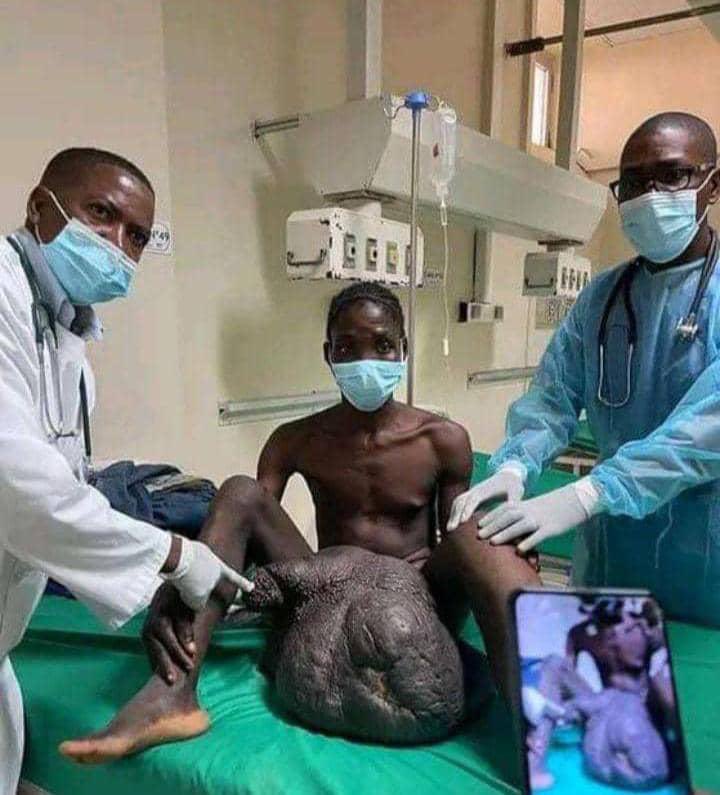 OriyomiOflagos's tweet photo. To enlarge his penis, he took medication but it was the testicles that generously obeyed the treatment. Dear young people Dear brothers Dear friends God did not make a mistake in giving you this penis. If you want to change it, you risk dying early. https://t.co/CMzLyqr60u