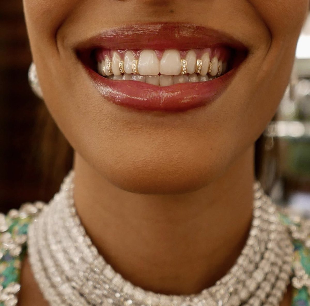 Grillz by Dolly Cohen