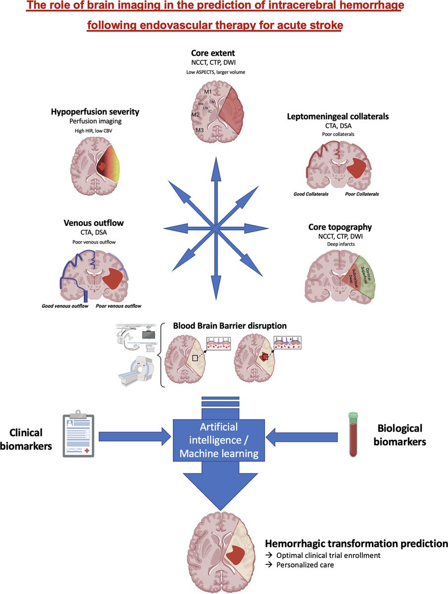 Stroke AHA/ASA (@strokeaha_asa) on Twitter photo Check out this #TopicalReview by Seners et al summarizing the literature on imaging biomarkers in predicting post-EVT ICH. #stroke #AHAJournals ahajournals.org/doi/10.1161/ST…
<a href="/GregZ_MD/">Greg Zaharchuk</a> <a href="/JeremyHeitMDPHD/">Jeremy Heit, MD, PhD</a> <a href="/BenjaminMaierMD/">Benjamin Maïer</a> Check out this #TopicalReview by Seners et al summarizing the literature on imaging biomarkers in predicting post-EVT ICH. #stroke #AHAJournals ahajournals.org/doi/10.1161/ST…
<a href="/GregZ_MD/">Greg Zaharchuk</a> <a href="/JeremyHeitMDPHD/">Jeremy Heit, MD, PhD</a> <a href="/BenjaminMaierMD/">Benjamin Maïer</a>