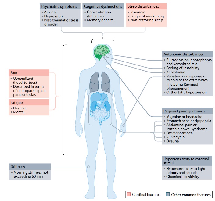 La fibromialgia es caracteritza per la seva complexitat en quant als símptomes que presenta, a tenir en compte a l'hora de preescriure exercici! nature.com/articles/s4158…