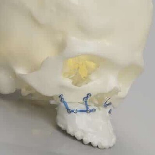 The Past and Present of 3D Printing in Maxillofacial Surgery bit.ly/3wMA0LT #ExpertCorner #medical3dprinting #bioprinting #3DTech