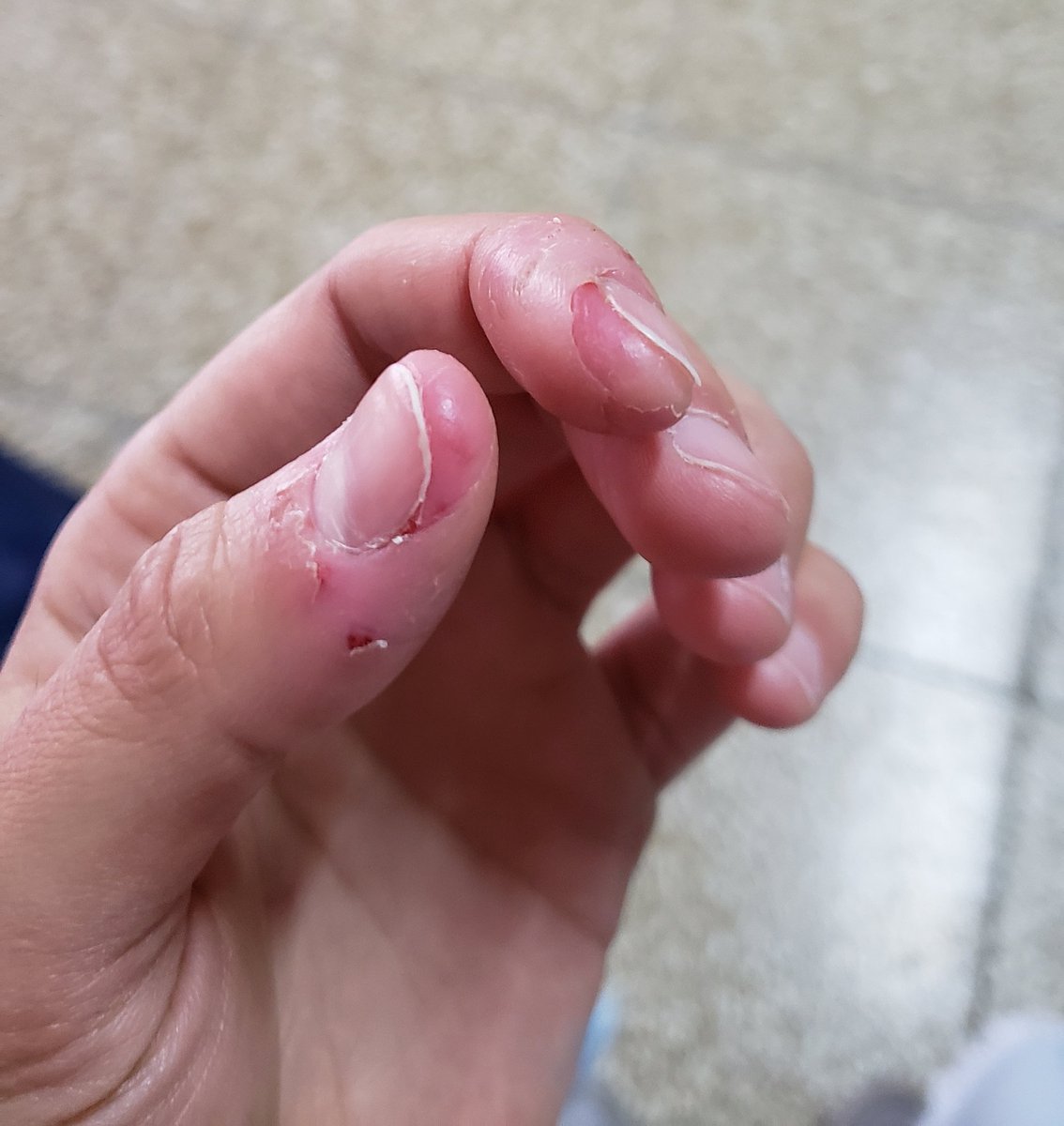Mi verdadero no tengo autocontrol