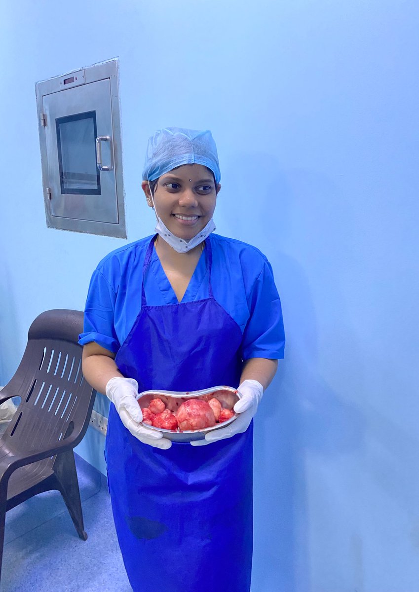 Akhila_doc's tweet photo. #MedTwitter
Happy to share
Multiple fibroids removal in an unmarried 22yrs Girl,with DUB. Came to me for the 1st time, saying she was very much stressed and tired of heavy menstrual bleeding and being anemic since 2yrs &amp; relatives insisted hysterectomy for this young girl..(1/5) https://t.co/9mJJGvysHZ