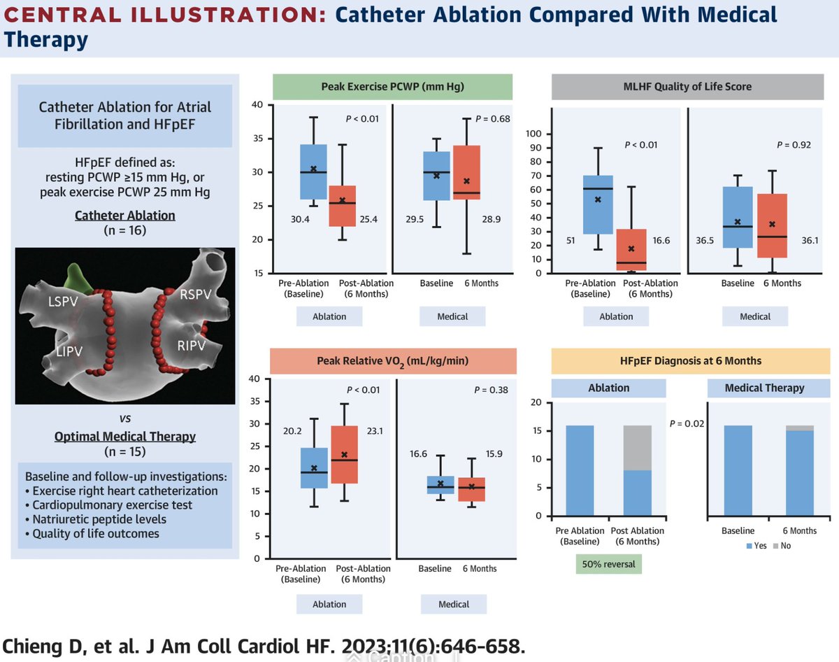 Small but impactful study on AF ablation in HFpEF patients!⚡️
Larger studies are underway to support these findings! Are some HFpEF diagnosis mainly due to AF?🧐

jacc.org/doi/abs/10.101…

<a href="/Phiso_de/">Philipp Sommer</a> <a href="/EPDeneke/">Thomas Deneke</a> <a href="/RolandTilz/">Roland Tilz</a> <a href="/AriSultanEP/">Arian Sultan</a> <a href="/ChristianHeeger/">Christian-H. Heeger</a>