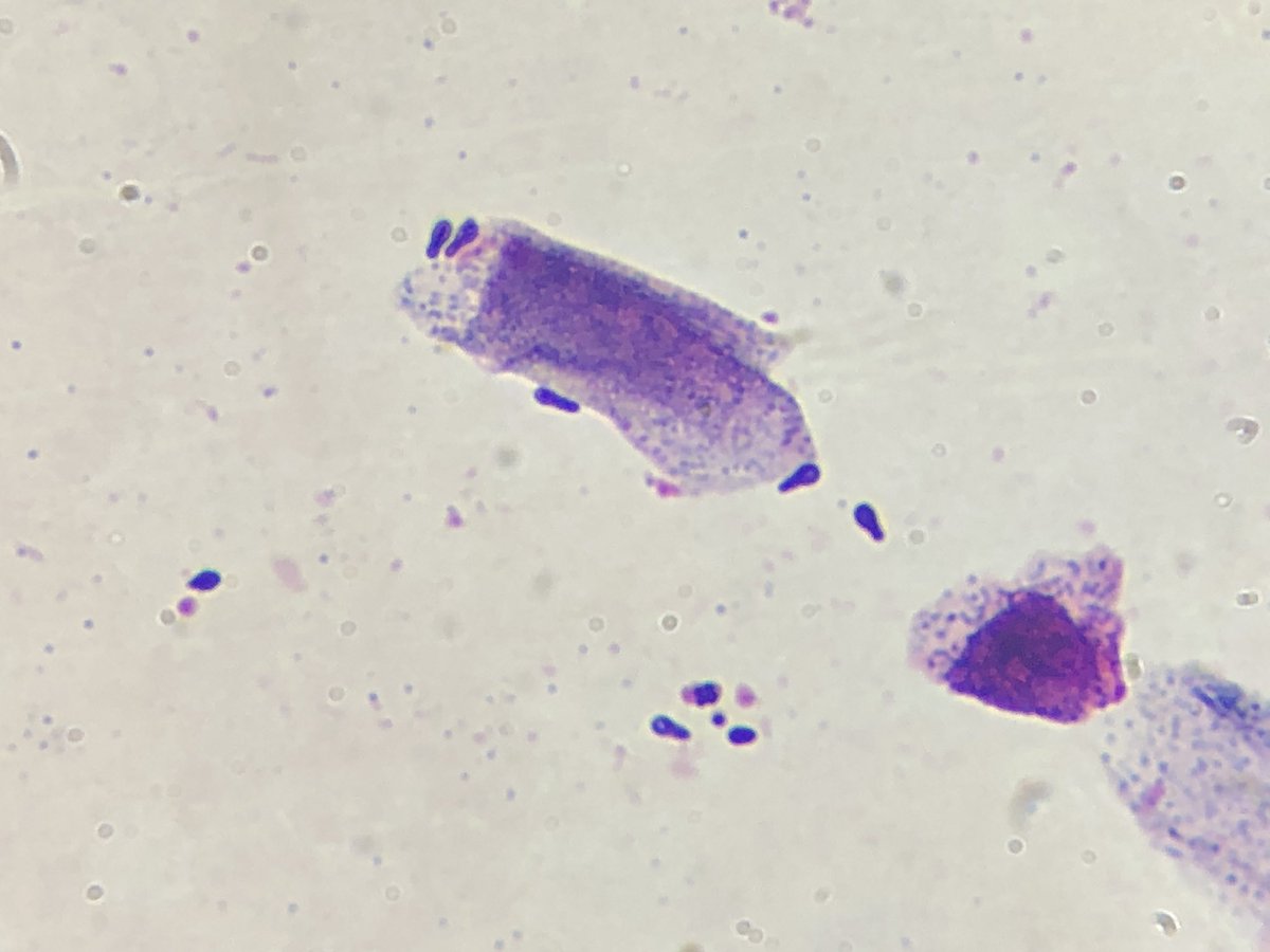 MicologiaC's tweet photo. Fungal otitis caused by Malassezia in a 3-year-old dog https://t.co/Mvg3vGkMmo