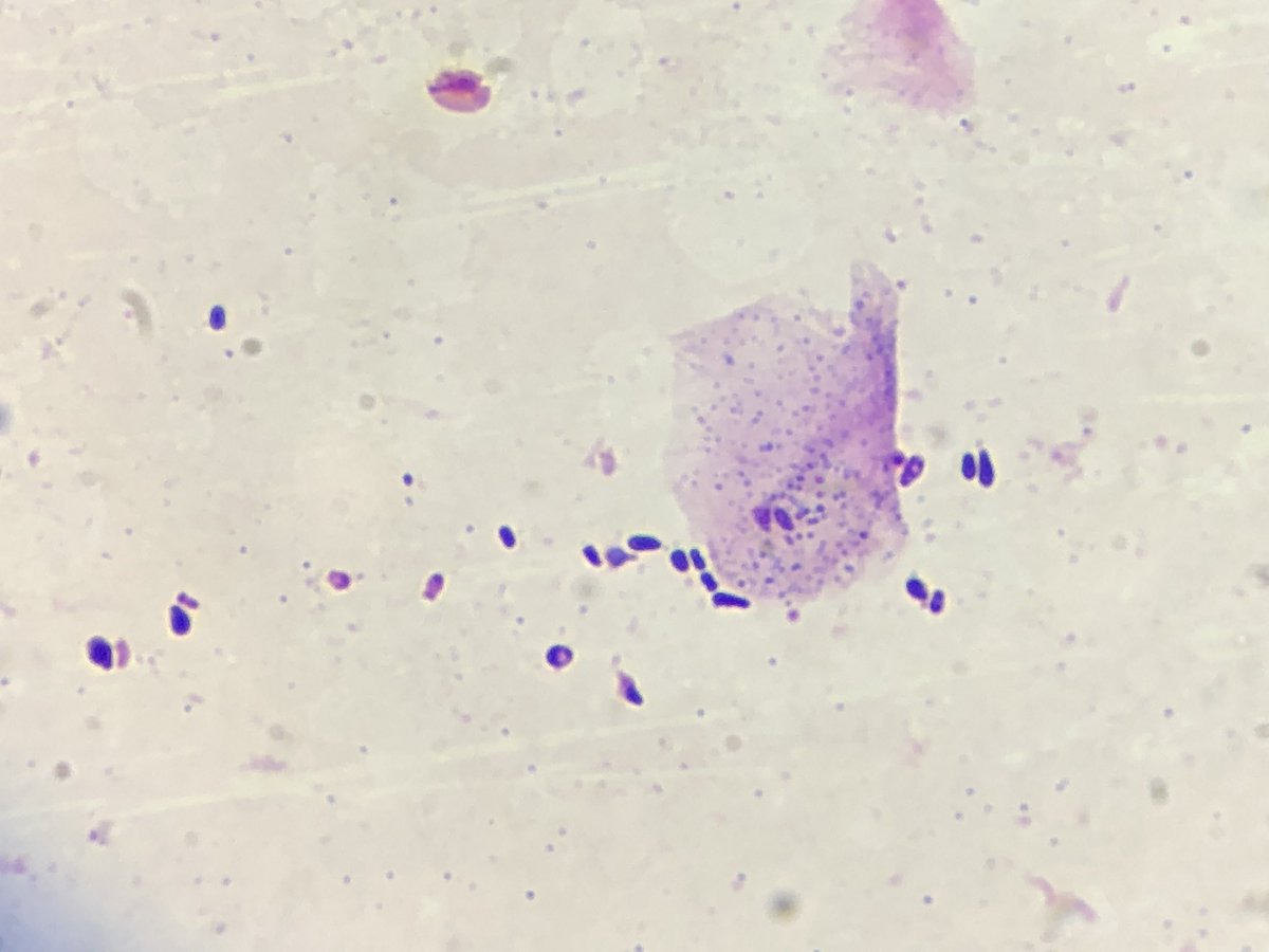 MicologiaC's tweet photo. Fungal otitis caused by Malassezia in a 3-year-old dog https://t.co/Mvg3vGkMmo