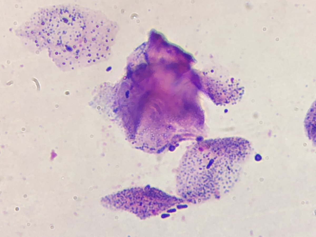 MicologiaC's tweet photo. Fungal otitis caused by Malassezia in a 3-year-old dog https://t.co/Mvg3vGkMmo