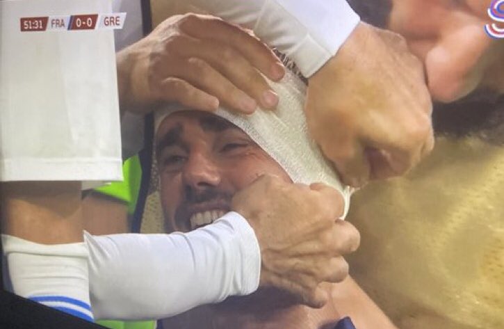 jackhatesgriz_'s tweet photo. griezmann just got kicked in the head and he’s laughing 😭 https://t.co/rNm6PbsWQT