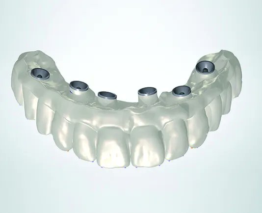 InDentalTech's tweet photo. In case you missed it! #MasterClassFlashback: “CAD/CAM Fabrication of Definitive Implant Prostheses” by Harold S. Baumgarten, DMD; and Alexander Wünsche, CDT https://t.co/pAw2woYk3P https://t.co/zC6R1WV8fw