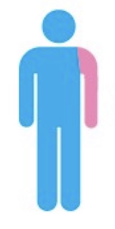 yo:
cuando tiro una piedra con la zurda