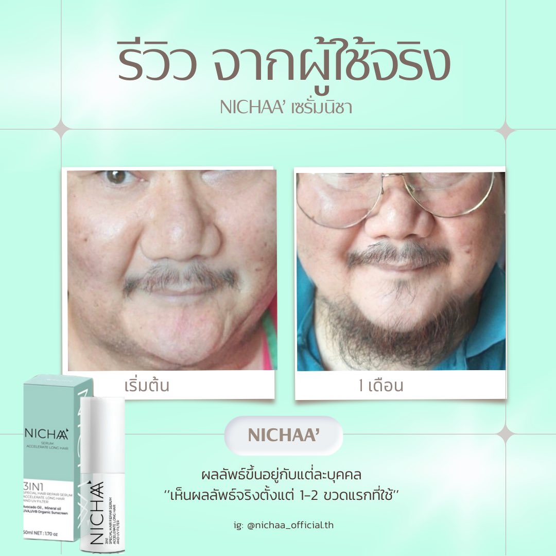NICHAA_OFFICIAL's tweet photo. ปัญหาคิ้วบาง ผมบาง หนวดเคราบาง แนะนำไอเท็มใหม่เลยจ้า เซรั่มนิชา ตัวนี้ดีมากๆ เห็นผลเร็ว ว้าวสุดๆ สอบถามรายละเอียดทักมาได้น้าาา #BrokenMelodiesBy7DREAM #ColdplayLiveinBangkok #ColdplaySingapore #Foundation #หนุ่มกะลา #แผ่นดินไหว #드림만의_청춘_브로큰멜로디스  #เซรั่มนิชา #ปลูกผม https://t.co/jwVNN3rsSi