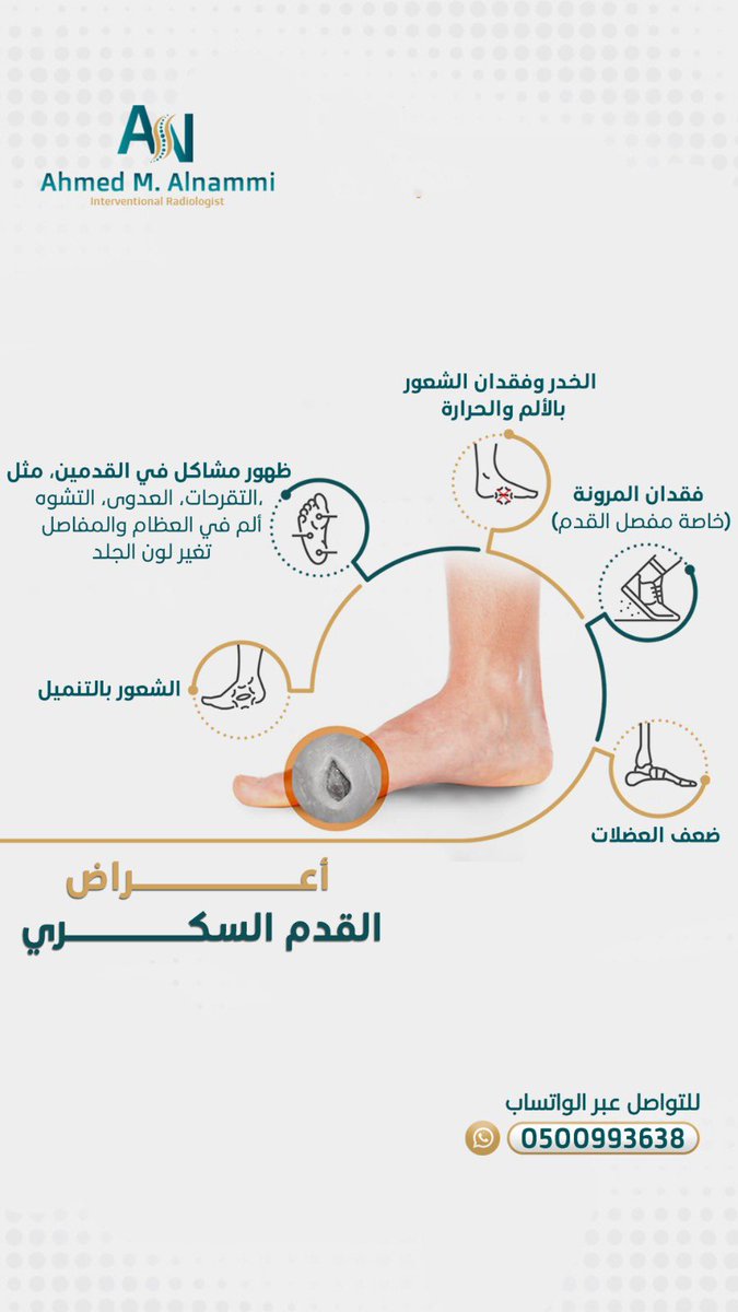 انقذ قدما تنقذ نفسا