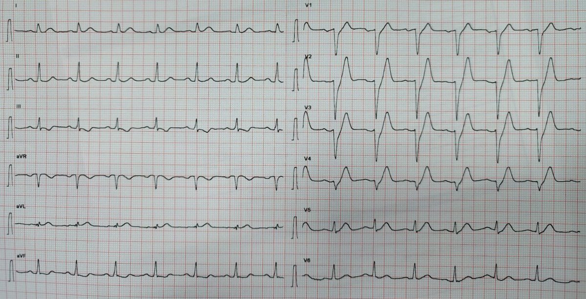 Chest pain

DX ?