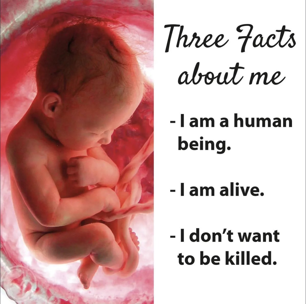 #UnbornLivesMatter #ProLife #ProChoice #Abortion #AbortionIsMurder #AbortionIsHealthcare (the hell it is)