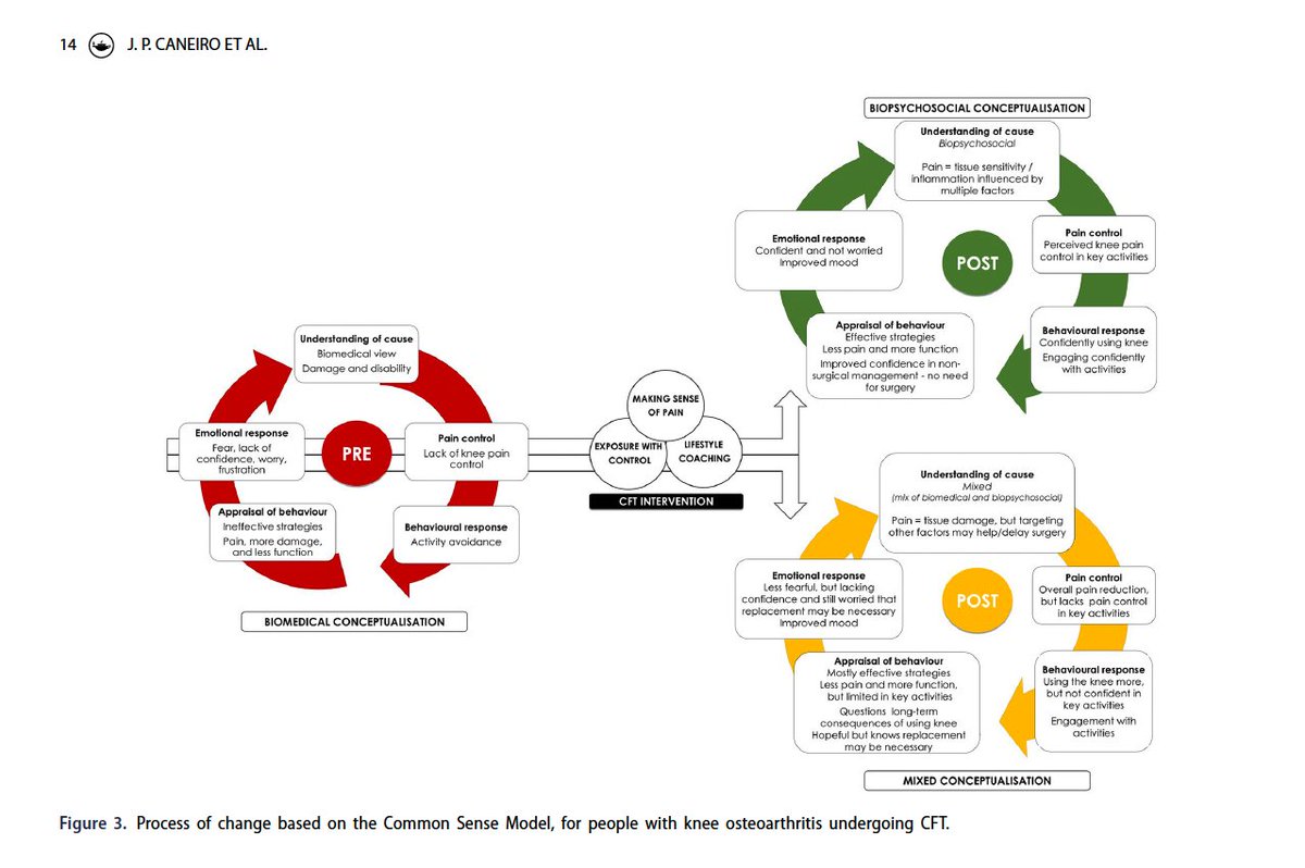 Process of change for people with knee osteoarthritis undergoing cognitive functional therapy: a replicated single-case experimental design study. Well done @jpcaneiro and team for this work. tandfonline.com/doi/full/10.10…