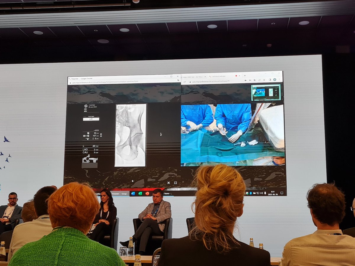 Venous News (@venousnews) on Twitter photo The <a href="/BDandCo/">BD</a> #Venous summit is treated to a live case from Nils Kucher and co at <a href="/UZH_en/">University of Zurich</a>, involving reconstruction of the left iliac and common femoral #Veins due to post-thrombotic syndrome
#ThinkVenous <a href="/HoumanJalaie/">Houman Jalaie</a> <a href="/DrDoganc/">Prof. Dr. Suat Doğancı</a> <a href="/rodriguezmorata/">A.R.M.</a> <a href="/MoonJustaniah/">Almamoon Justaniah,MD, FSIR المأمون إبراهيم جستنيه</a> The <a href="/BDandCo/">BD</a> #Venous summit is treated to a live case from Nils Kucher and co at <a href="/UZH_en/">University of Zurich</a>, involving reconstruction of the left iliac and common femoral #Veins due to post-thrombotic syndrome
#ThinkVenous <a href="/HoumanJalaie/">Houman Jalaie</a> <a href="/DrDoganc/">Prof. Dr. Suat Doğancı</a> <a href="/rodriguezmorata/">A.R.M.</a> <a href="/MoonJustaniah/">Almamoon Justaniah,MD, FSIR المأمون إبراهيم جستنيه</a>