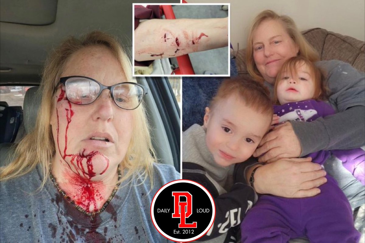 Wounded grandmother snaps bloody selfies on way to hospital after fighting off a pit bull to protect her grandkids 🙏😳